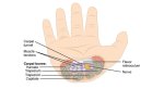 3025625-inline-i-1-how-to-stop-worrying-about-carpal-tunnel-syndrome